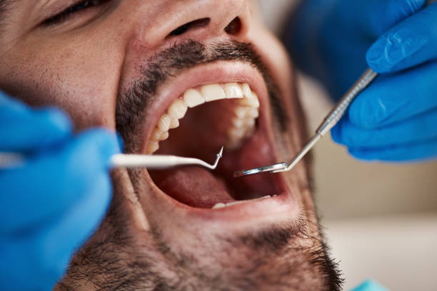 Best Full Mouth Reconstruction  in Willards, MD